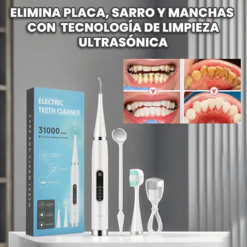 Removedor de Sarro ✨ Elimina placa y cálculos sin salir de casa
