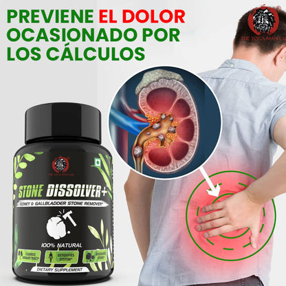 Stone Dissolver 💪😱 ¡Previene la formación de cálculos renales!