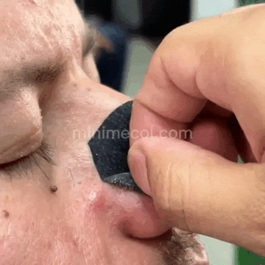 Black Head® Dile adiós a los puntos negros en minutos💥 ¡Pack x2! 💥